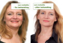Helle Sydendal før og efter behandling af lavt stofskifte