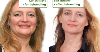 Helle Sydendal før og efter behandling af lavt stofskifte